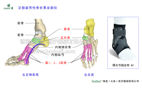 踝关节的构造与常见伤病