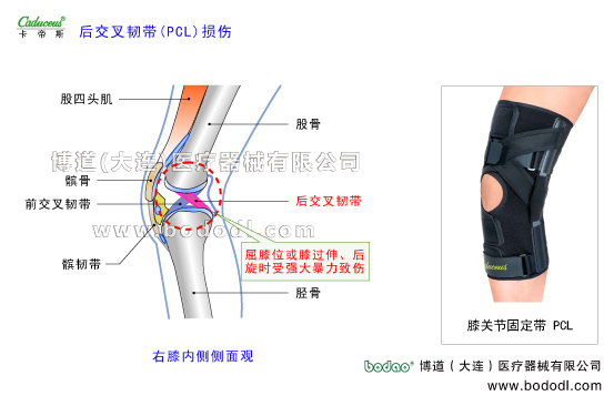 膝关节的运动损伤与防护