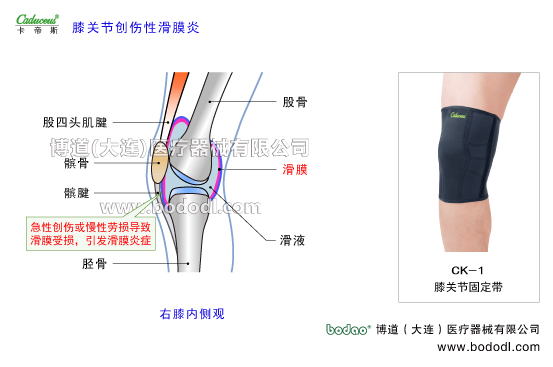 膝关节的运动损伤与防护