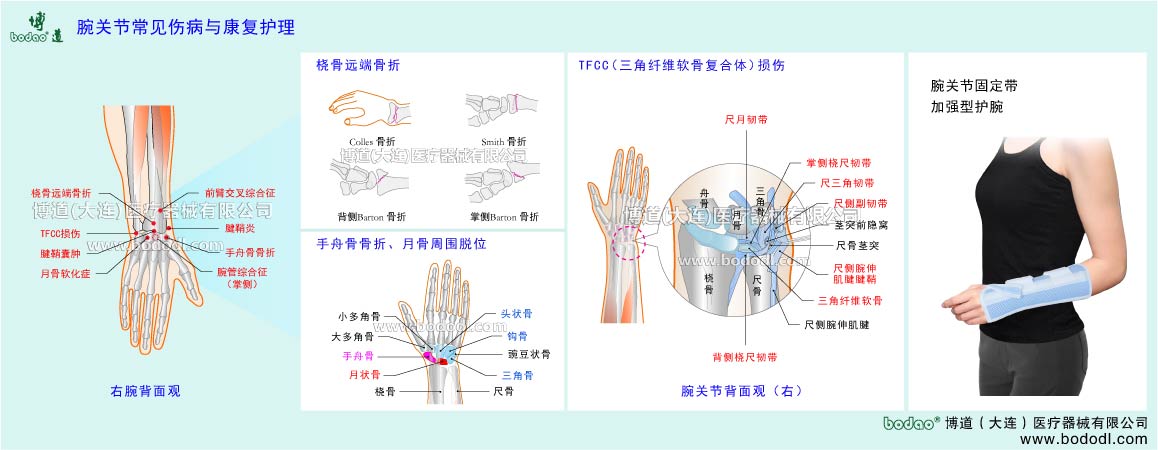 COMMON DISEASES OF  WRIST JOINT