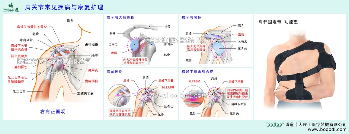 COMMON DISEASES OF SHOULDER JOINT 