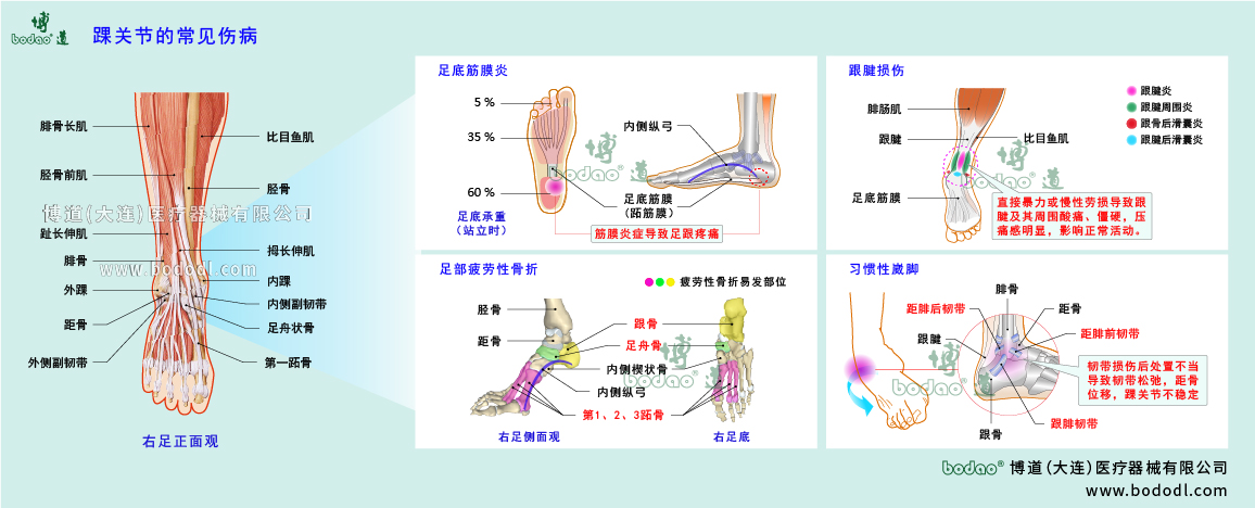 踝关节伤病的类型与症状