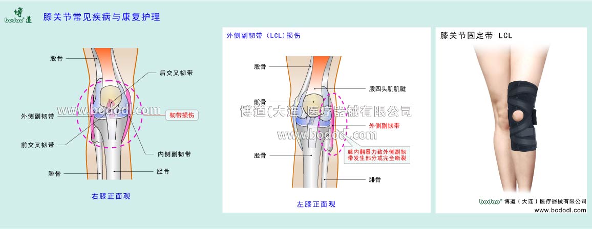 COMMON DISEASES OF KNEE JOINT 