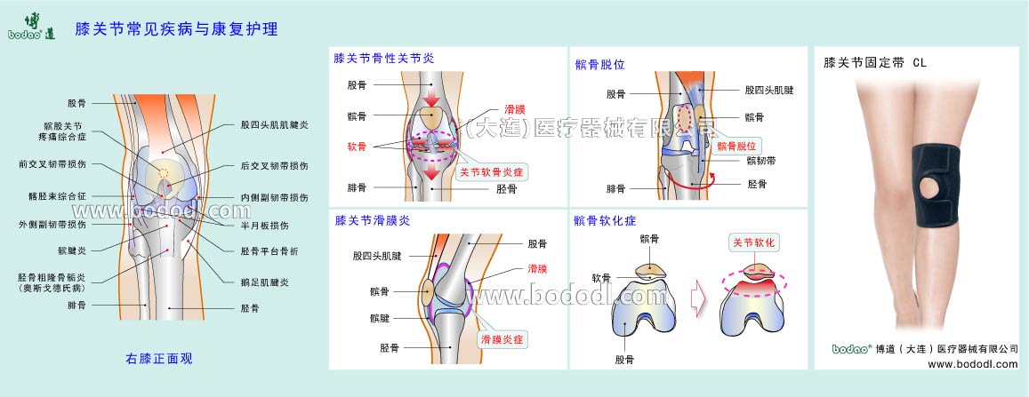 COMMON DISEASES OF KNEE JOINT 