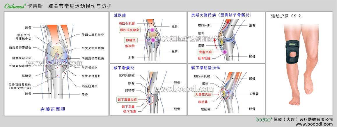 MAJOR SPORTS INJURY OF KNEE JOINT 