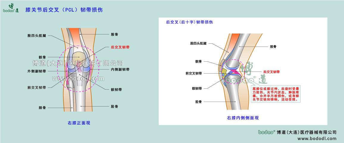膝关节疾病的类型与症状